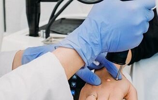 formas de eliminar las verrugas