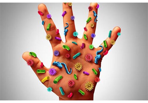 Los focos del virus del papiloma humano se encuentran en las manos. 